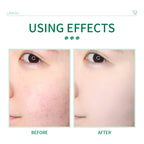 Centella Asiatica Facial Cleanser 50g for Pores