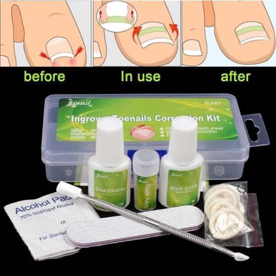 Nail Tips Set with Adhesive and Nail Art Sticks